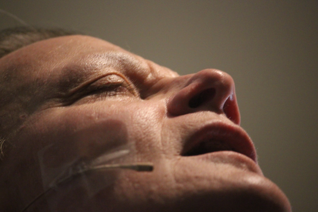 Nahaufnahme eines FrauenGesichts während eines Facelift-Vorgangs mit Nadeln in der Nase, Augen geschlossen, vor einer Wand.